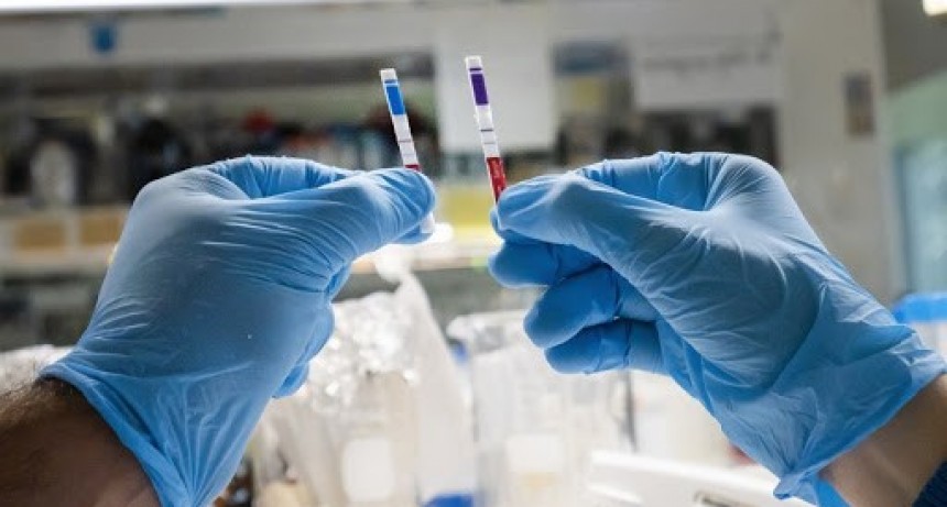 Coronavirus en San Francisco: reportaron 78 casos este martes y tres fallecimientos
